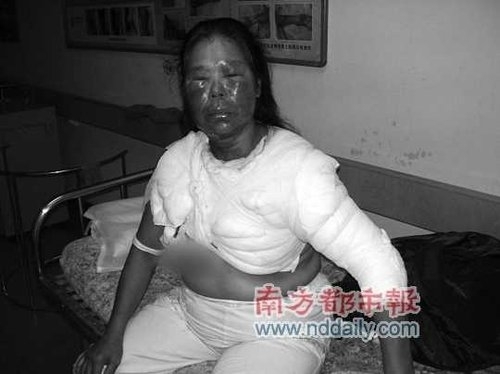 消費(fèi)者指先科電壓力鍋爆炸傷人 廠方稱其誹謗